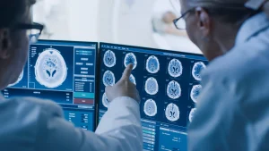 Doctors looking at brain scans.